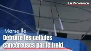 Marseille : détruire les cellules cancéreuses par le froid